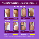 Crema reafirmante Gluteos